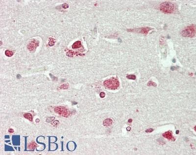 IHC-plus™ Polyclonal Rabbit anti-Human WWOX Antibody (N-Terminus, IHC, WB)