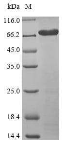 Human ISM1 Protein (Recombinant 10His-SUMO, N-terminus + Myc, C-terminus)