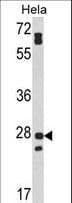 FAM3B Antibody (aa24-51)