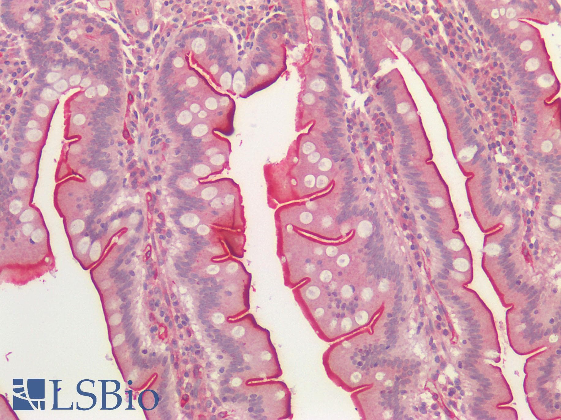IHC-plus™ Polyclonal Rabbit anti-Human ACE / CD143 Antibody (IHC)
