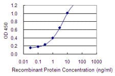 DDC / DOPA Decarboxylase Antibody (clone 8E8)