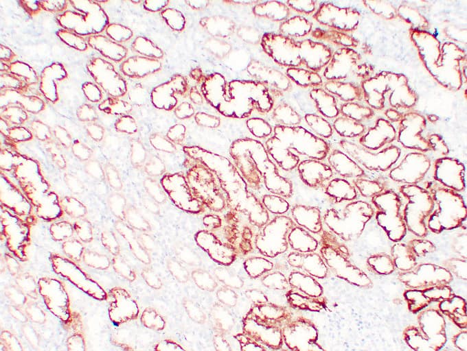 VHL / Von Hippel Lindau Antibody (clone ABT-PVHL)
