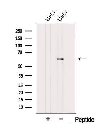 TCBE / KCS / HRD Antibody