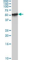 PathPlus™ FOXA1 Antibody (clone 3C1)