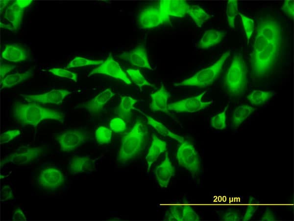 IHC-plus™ Monoclonal Mouse anti-Human HSET / KIFC1 Antibody (clone 2B9, IHC, IF, WB)