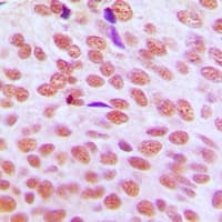 CBX5 / HP1 Alpha Antibody (Internal)