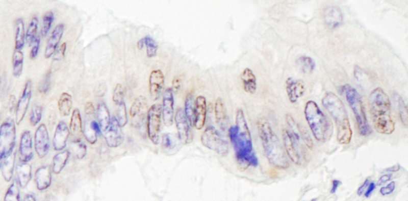 KDM4A / JHDM3A / JMJD2A Antibody (aa350-400)
