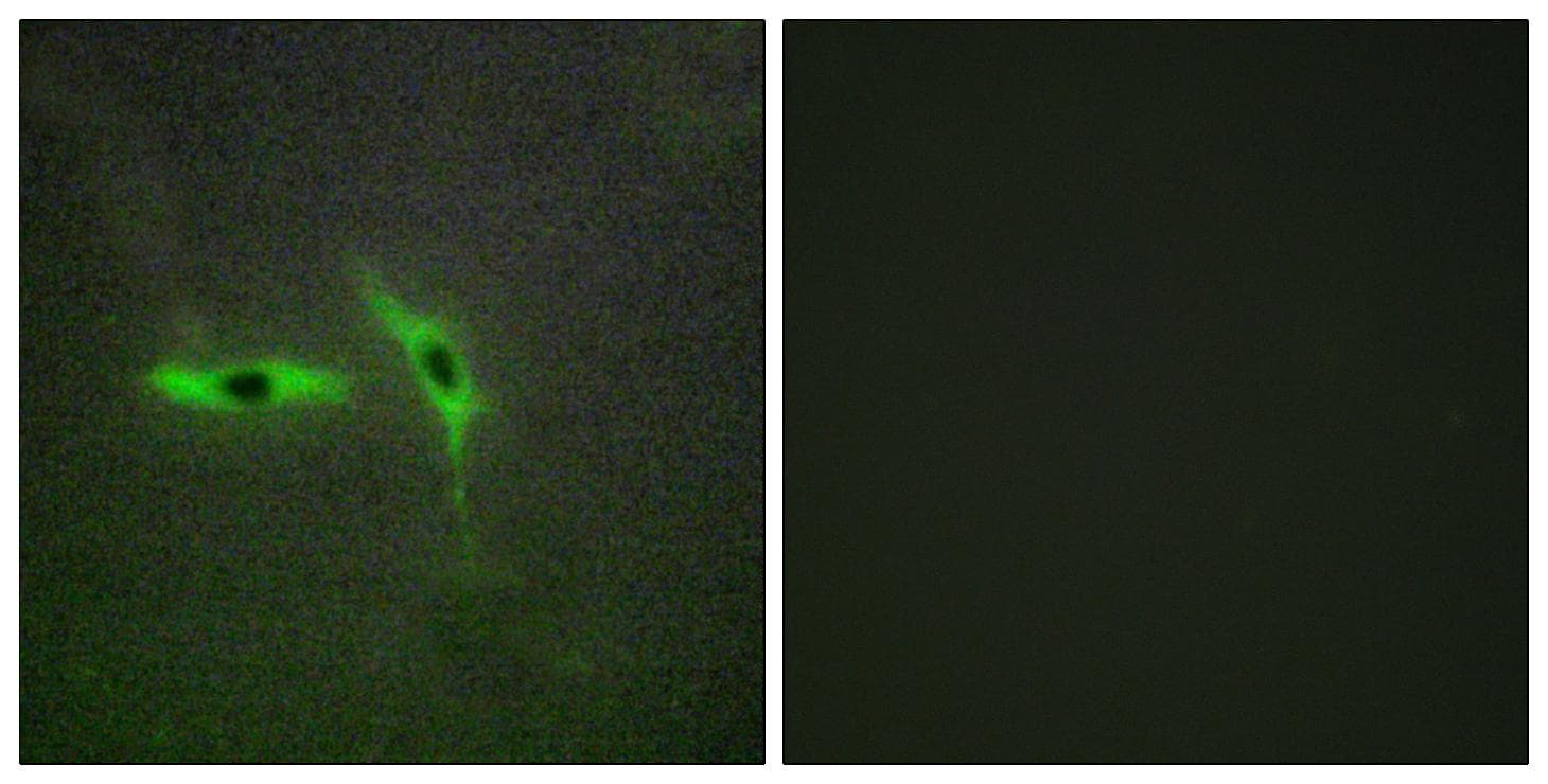 Polyclonal Rabbit anti-Human TNFRSF6B / DCR3 Antibody (IHC, IF, WB)