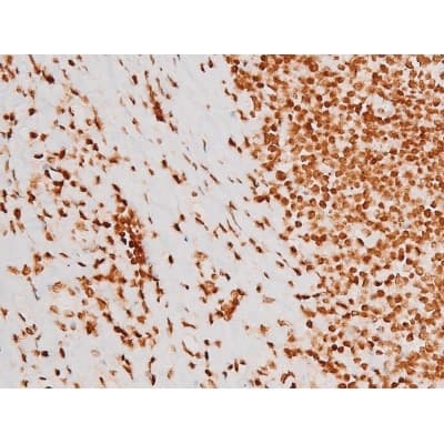 REL / C-Rel Antibody (phospho-Ser503)