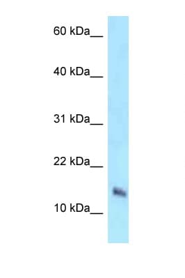 NDUFB7 / B18 Antibody (aa23-72)