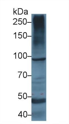 INSR / Insulin Receptor Antibody (aa1024-1298)