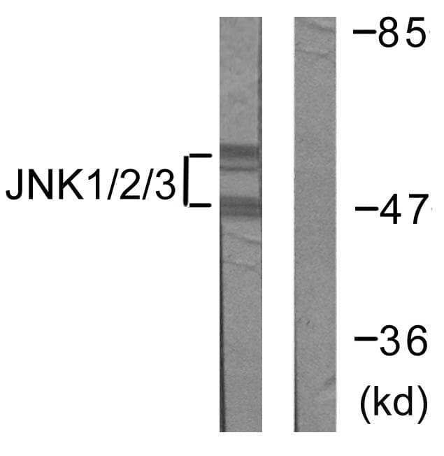Polyclonal Rabbit anti-Human MAPK8 / JNK1 Antibody (Ab-183/185, IHC, IF, WB)