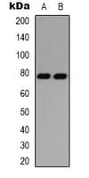PRKCD / PKC-Delta Antibody (C-Terminus)