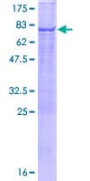 Human TBC1D2 Protein (Recombinant GST)