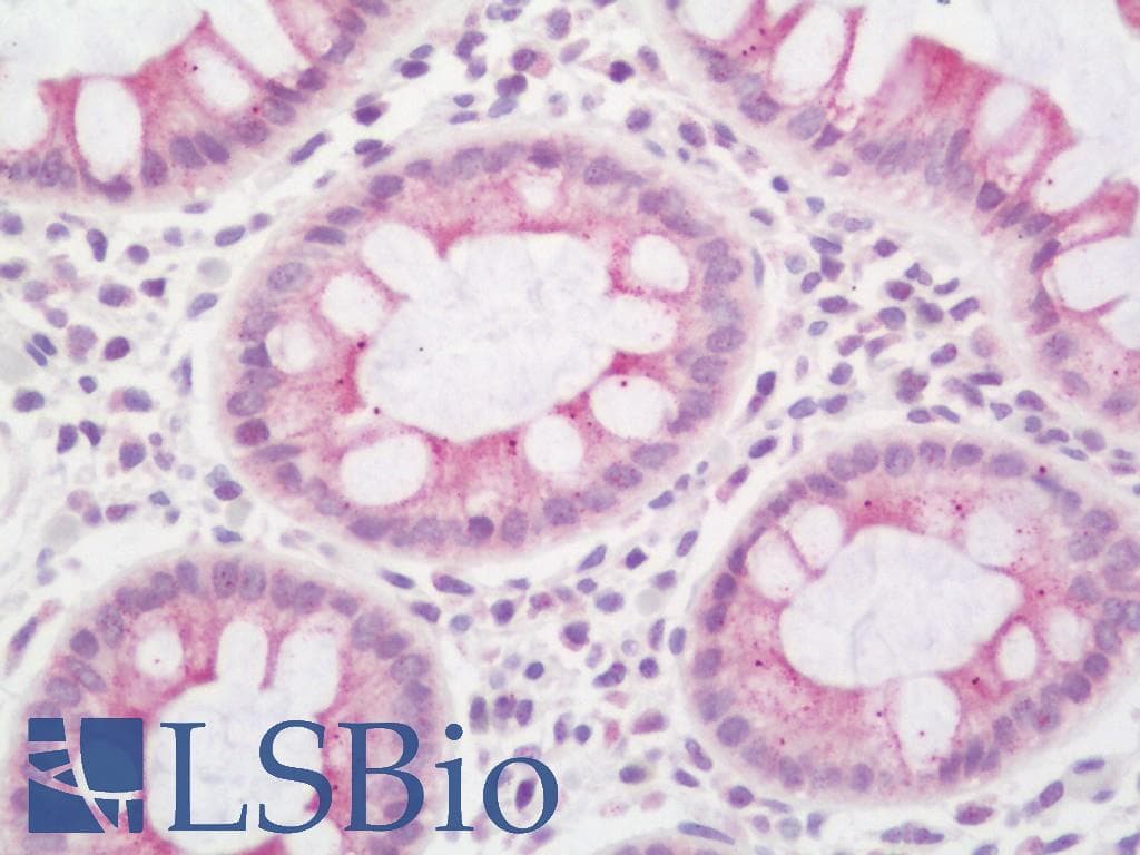IHC-plus™ SCN4B Antibody (aa61-110)