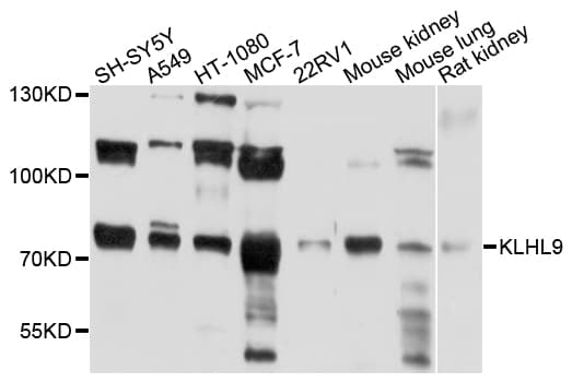 KLHL9 Antibody