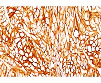 Cytokeratin 1+8 Antibody (clone DA7, Ready-to-Use)