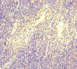 Polyclonal Rabbit anti-Human NFATC1 / NFAT2 Antibody (IHC, IF)