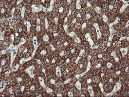 ACAA2 Antibody (clone OTI1D3)