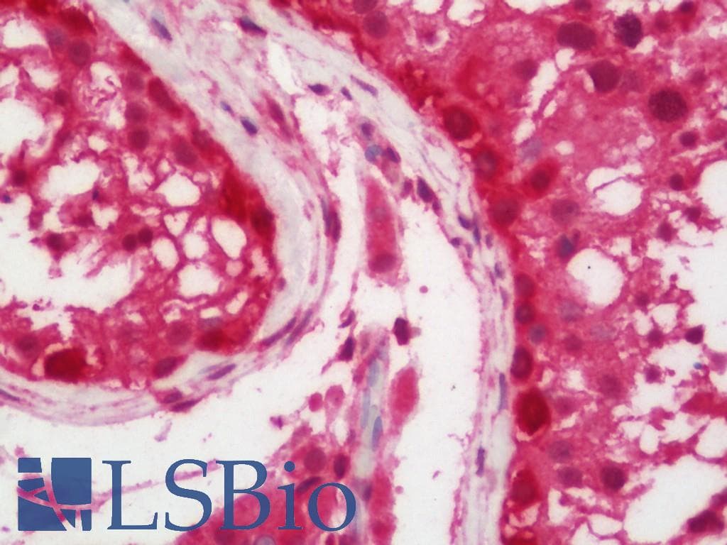 ELAVL2 / HUB Antibody (HRP)