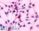 IHC-plus™ C5AR1 / CD88 / C5a Receptor Antibody (N-Terminus)