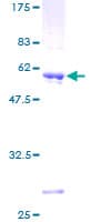 Human DGUOK / Deoxyguanosine Kinase Protein (Recombinant GST)