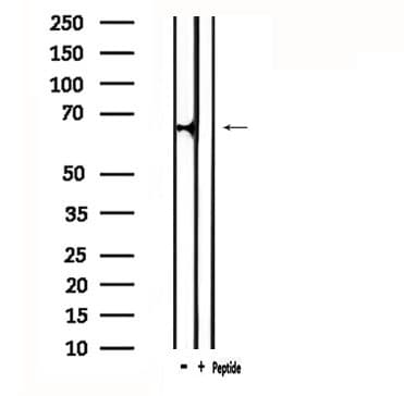 ATG16L2 Antibody