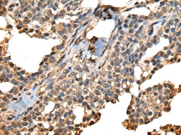 PHF21A / BHC80 Antibody
