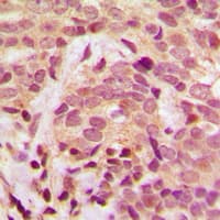 IKBKG / NEMO / IKK Gamma Antibody (phospho-Ser31)
