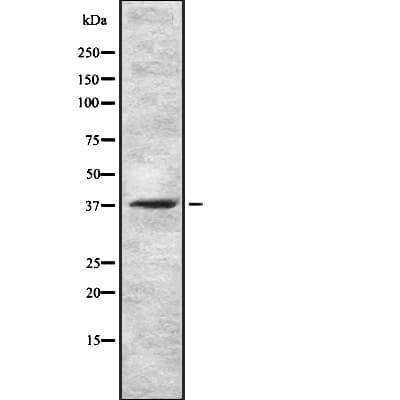 GnRH receptor / GNRHR Antibody