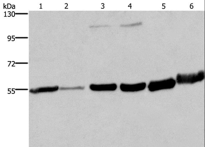 Polyclonal Rabbit anti-Human MCHR1 Antibody (IHC, WB)