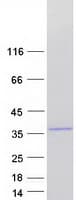 Human HAUS1 / CCDC5 Protein (Recombinant Myc-DDK (Flag))