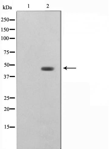 DNAJB1 / Hsp40 Antibody