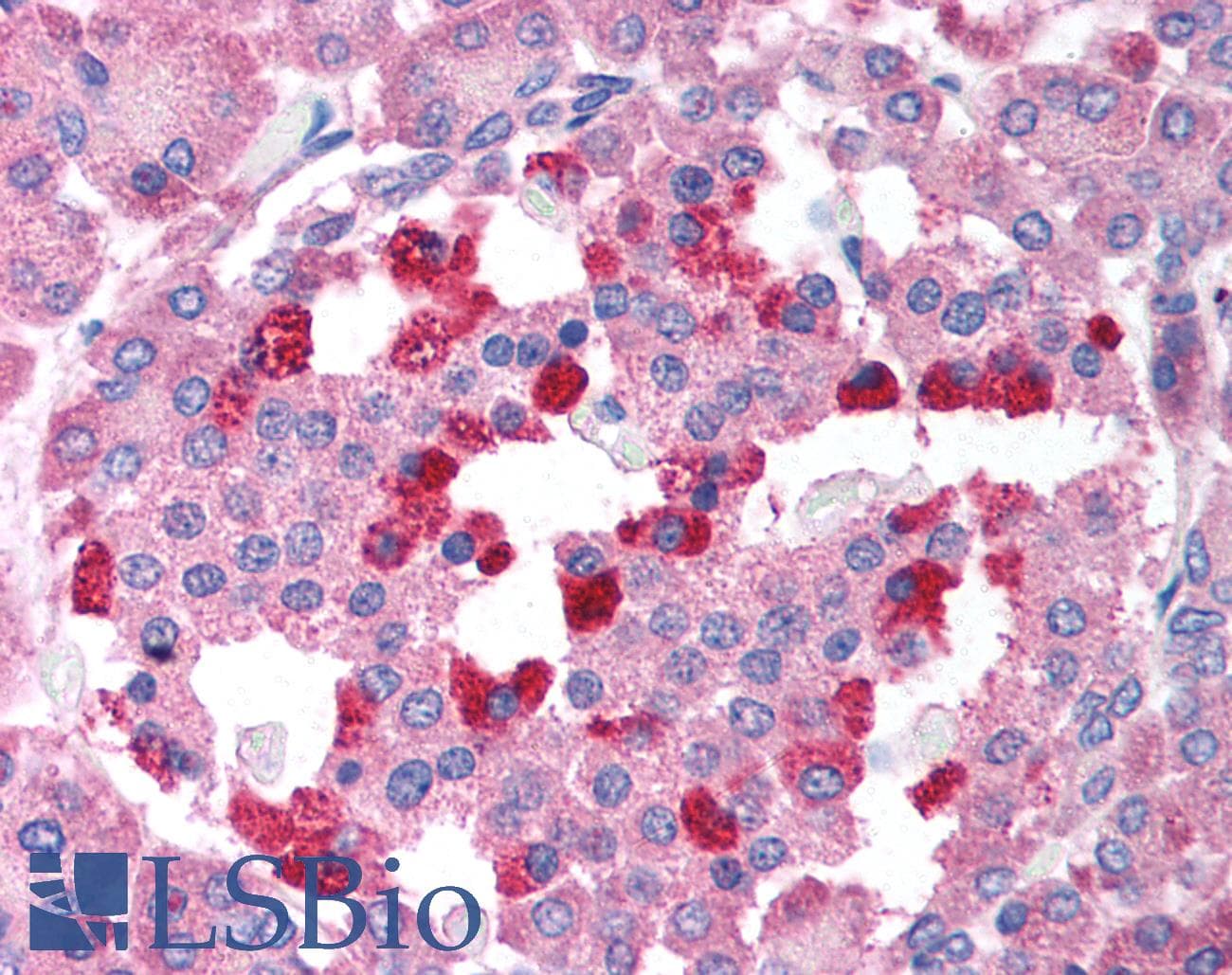 IHC-plus™ BCL2L14 / BCL-G Antibody