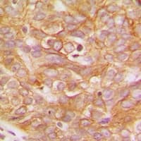 LYN Antibody (C-Terminus)