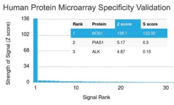 POU2AF1 / BOB1 Antibody (clone BOB1/2424)