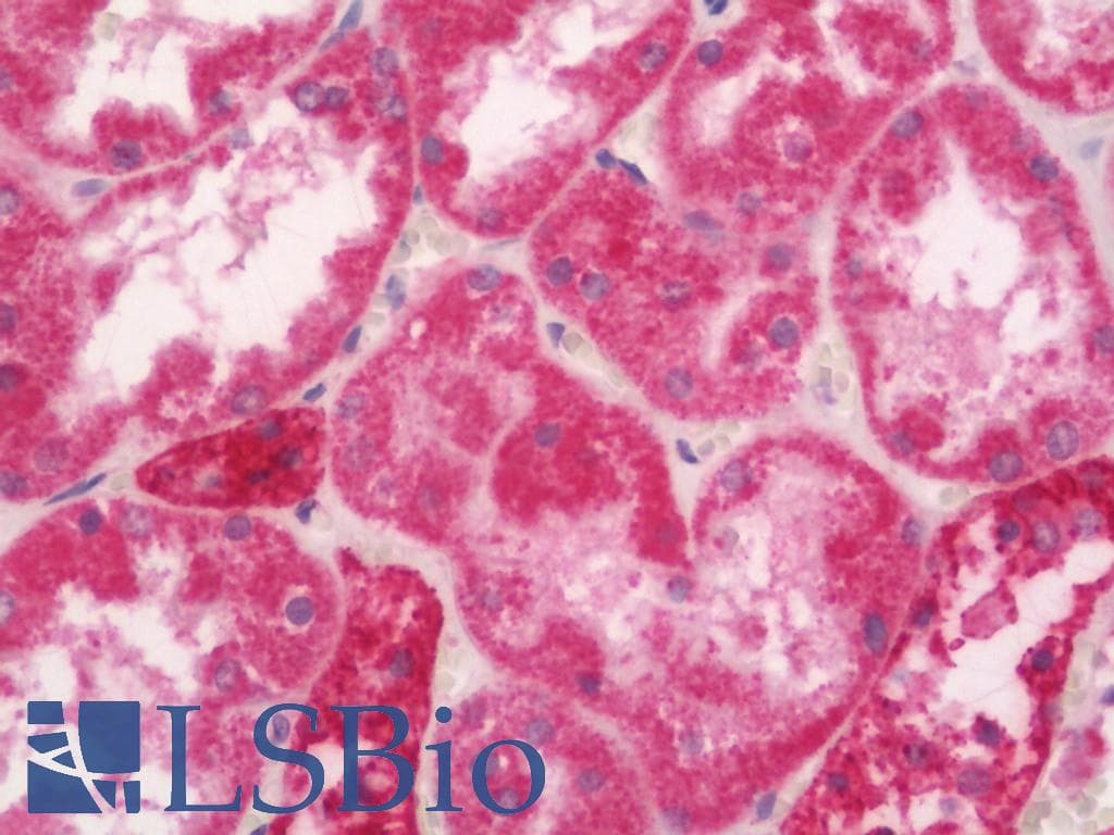 IHC-plus™ Polyclonal Rabbit anti-Human BCKDHA / BCKDE1A Antibody (C-Terminus, IHC, IF, WB)