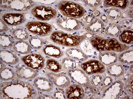 ABCB1 / MDR1 / P Glycoprotein Antibody (aa995-1280, clone OTI2H2)
