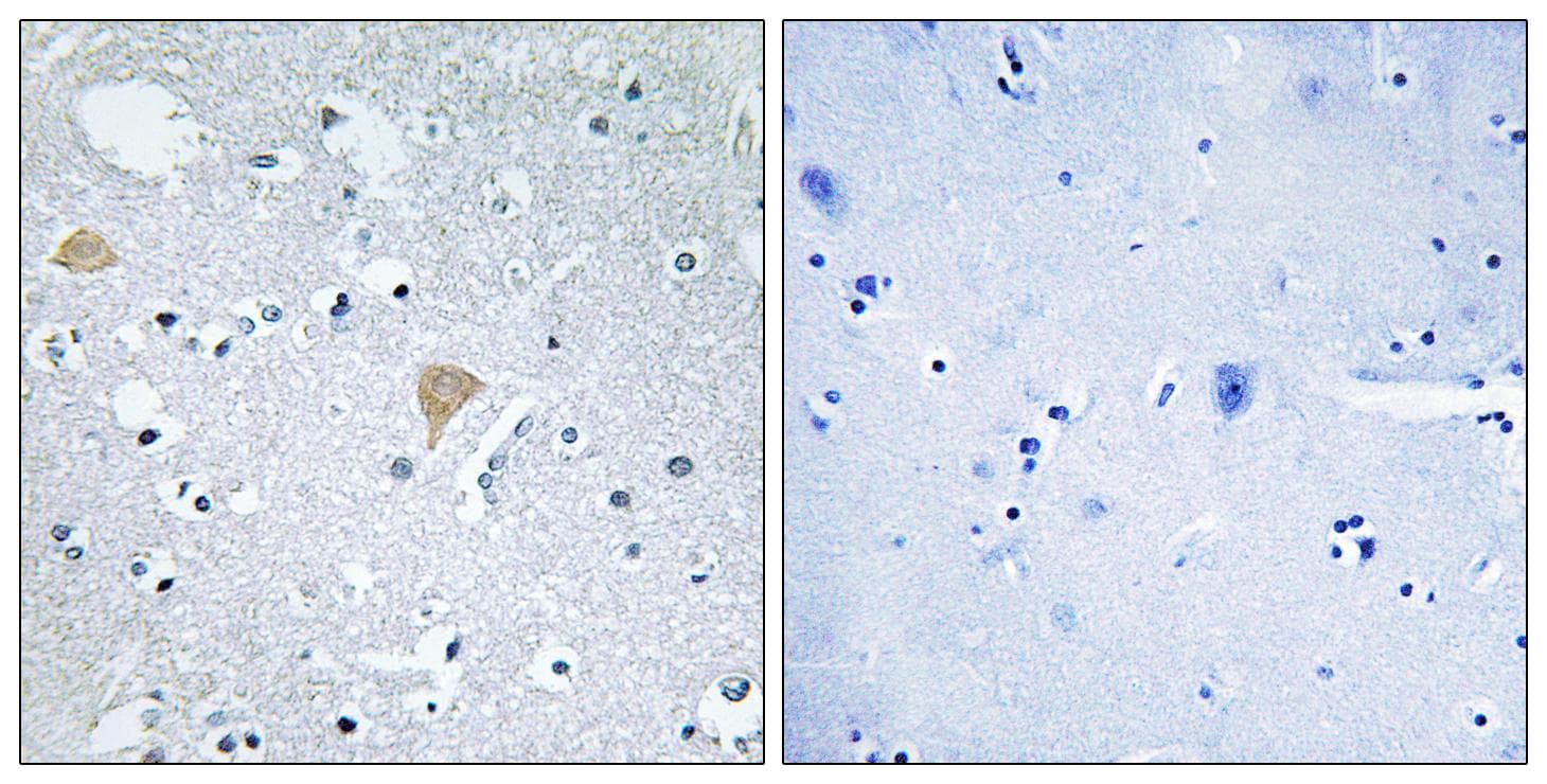 Polyclonal Rabbit anti-Human CIT / CRIK / Citron Antibody (IHC, IF)