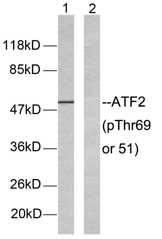 Polyclonal Rabbit anti-Human ATF2 Antibody (phospho-Thr69/Thr51, IHC, WB)