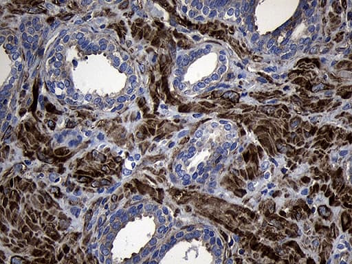 MLC3F / MYL1 Antibody (aa2-150, clone OTI4E3)
