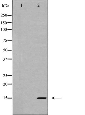 Polyclonal Rabbit anti-Human IL5 Antibody (IHC, WB)