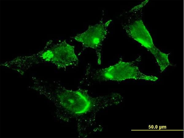 IHC-plus™ GOLM1 / GP73 / GOLPH2 Antibody (clone 5B10)