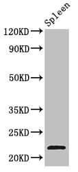 TPD52L2 / HD54 Antibody