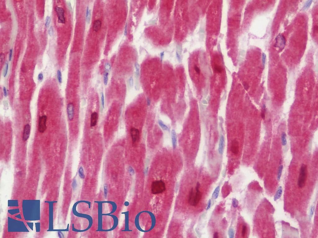 IHC-plus™ CAMK2D / CaMKII Delta Antibody (aa249-445)