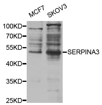 Alpha-1-Antichymotrypsin Antibody