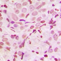 SRF / Serum Response Factor Antibody (phospho-Ser103)