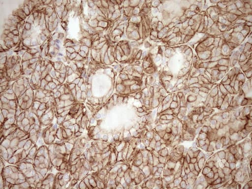 Monoclonal Mouse anti-Human EPLIN Antibody (clone OTI9F3, aa1-275, IHC, WB)