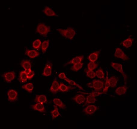 Polyclonal Rabbit anti-Human CD55 Antibody (IF, WB)