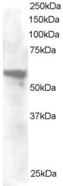 IHC-plus™ ANXA11 / Annexin XI Antibody (aa8-20)